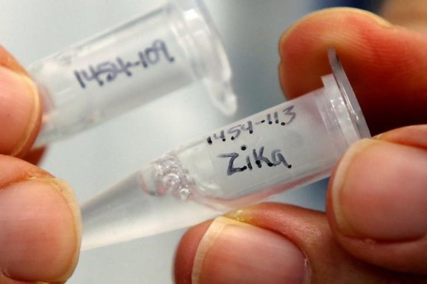 Deux modes de transmission du virus Zika de la mère à l’enfant