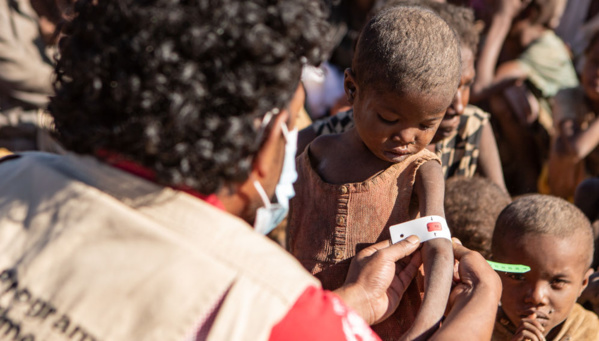 L’année de la pandémie de Covid-19 marquée par une hausse de la faim en Afrique (ONU/UA)