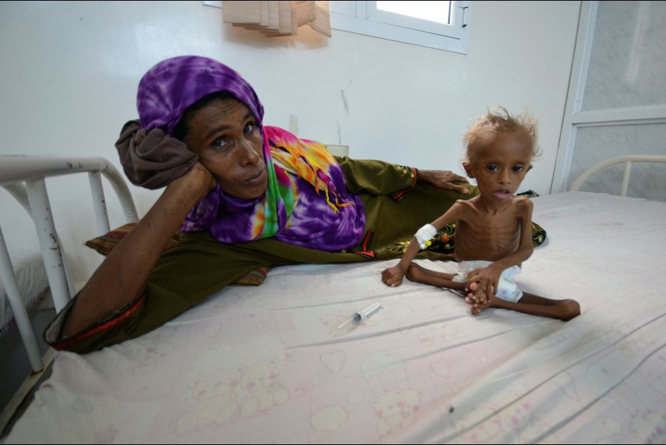Près de 1,5 million d'enfants ont faim au Yémen