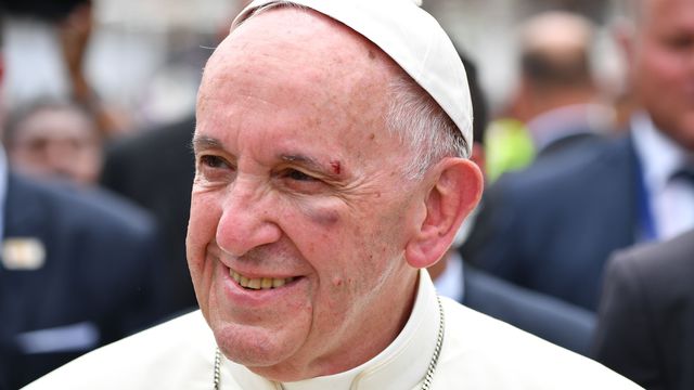 La papamobile freine brutalement: le pape François légèrement blessé