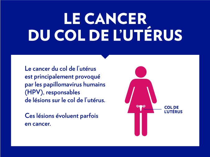 CANCER DU COL : Le plan stratégique de lutte permettra de connaître l’ampleur de la maladie