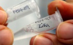 Deux modes de transmission du virus Zika de la mère à l’enfant