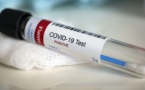 Covid-19: 3 morts, 380 nouvelles infections